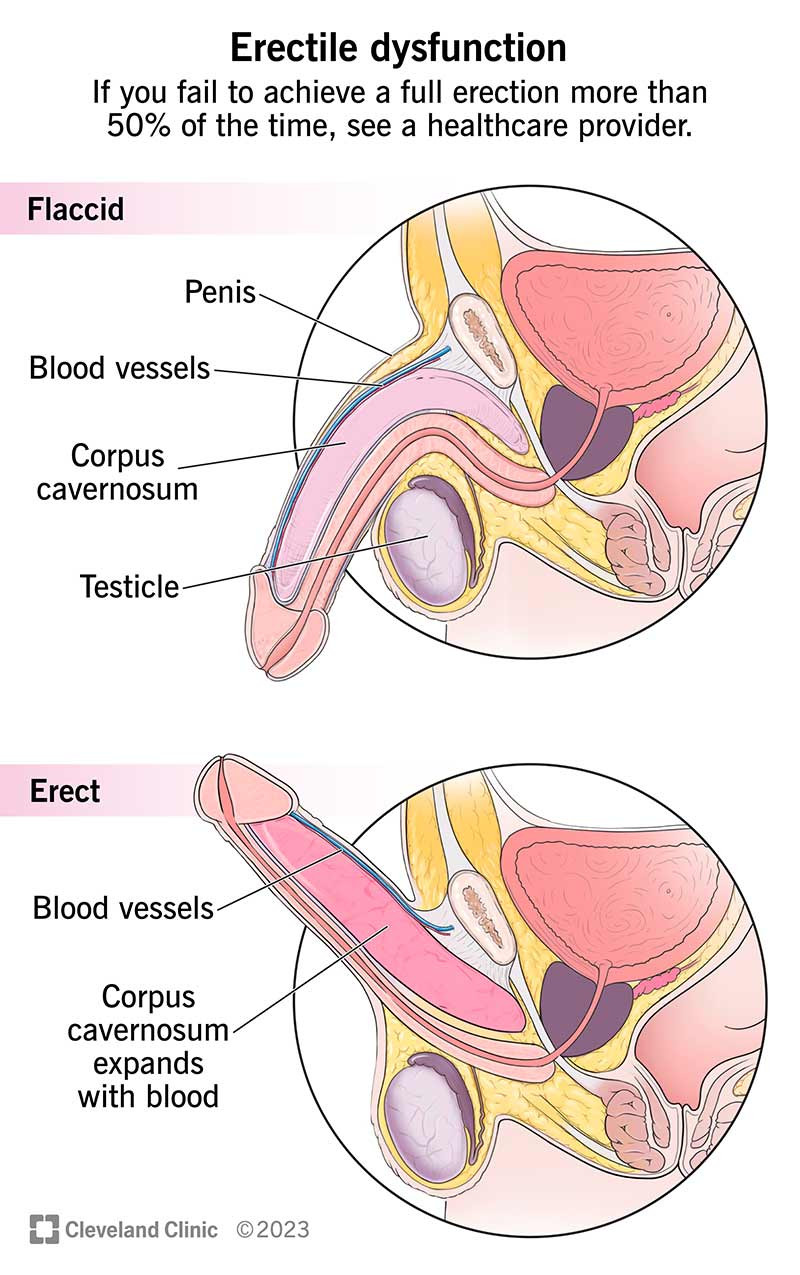  Source: Cleveland Clinic