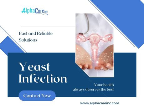 The Complete Guide to Treating Yeast Infections: Fast and Reliable Solutions